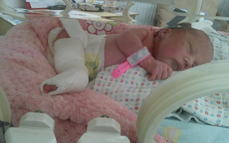 Zbiórka walka Maryśki z artrogrypozą - zdjęcie główne