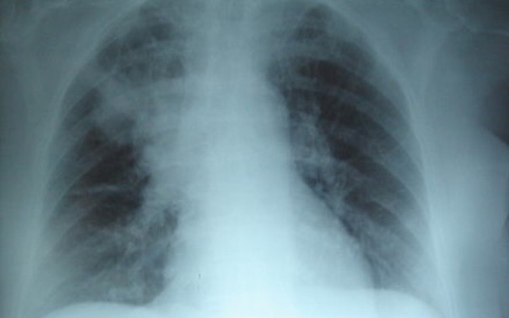 Zbiórka MUKOWISCYDOZA-uratuj mnie! - zdjęcie główne