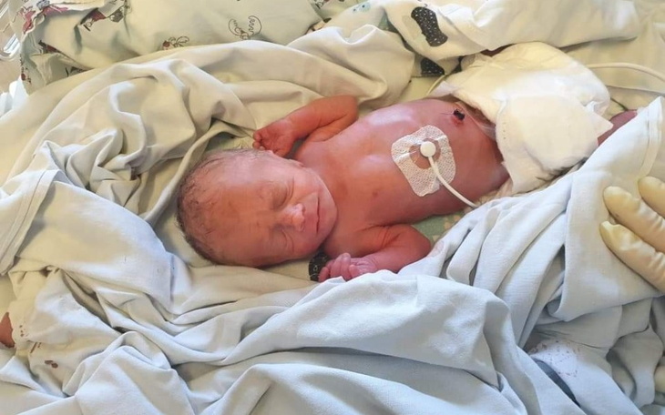 Zbiórka Zbiórka dla małej Zoyki - zdjęcie główne