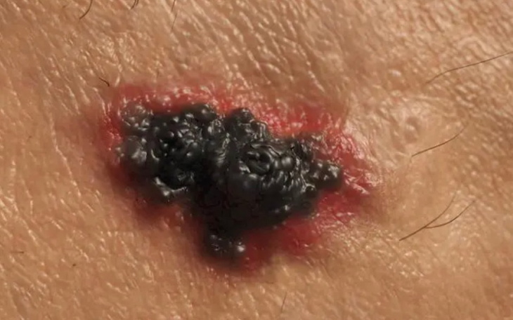 Zbiórka Czerniak - zdjęcie główne