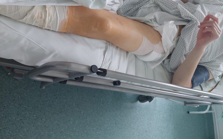 Zbiórka Zbiórka na rehabilitację Antka - zdjęcie główne