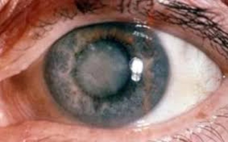 Zbiórka Zaćma u Matki - zdjęcie główne