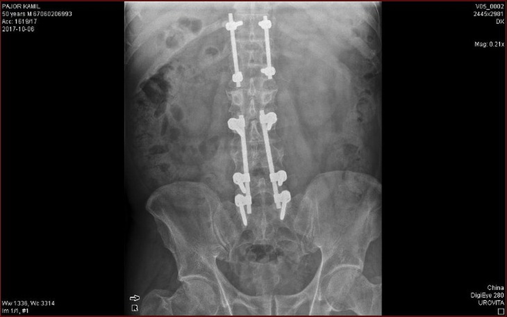 Zbiórka Leki Operacja Rehabilitacja - zdjęcie główne