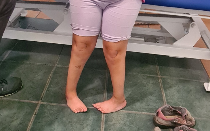 Zbiórka Zaopatrzenie ortopedyczne - zdjęcie główne