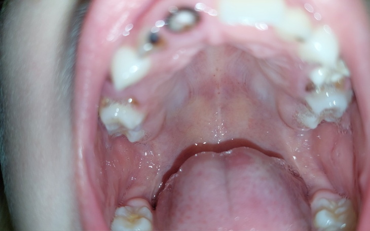 Zbiórka Zbieram na nowy usmiech - zdjęcie główne