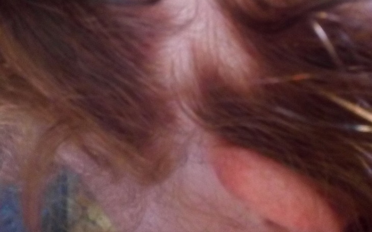 Zbiórka Leczenie i peruka - zdjęcie główne