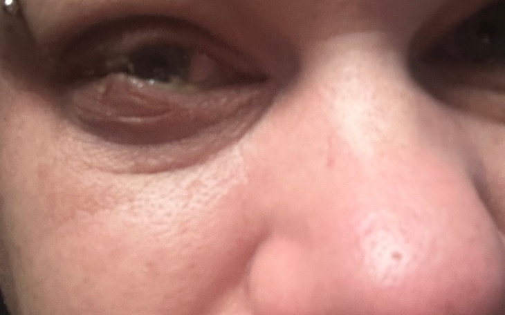 Zbliżenie na twarz z widocznymi zmarszczkami i oczami.