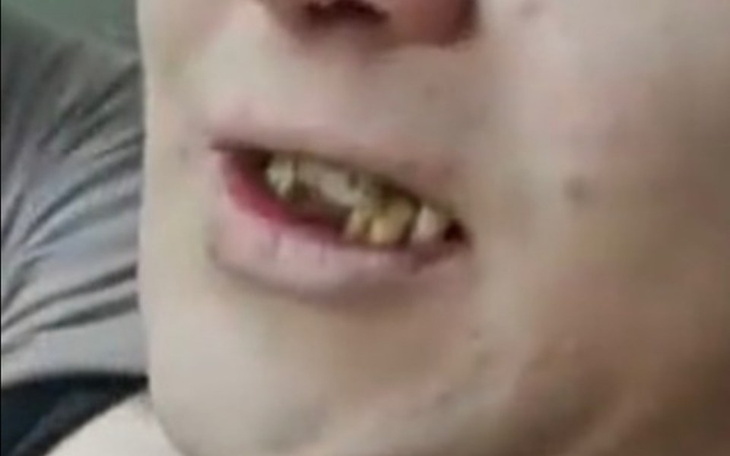 Zbiórka Zbieramy kwotę na uzębienie Moni - zdjęcie główne