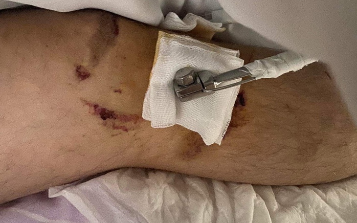 Zbiórka Powrót po wypadku - zdjęcie główne