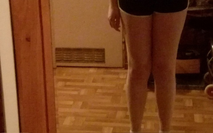 Zbiórka Nogi - zdjęcie główne