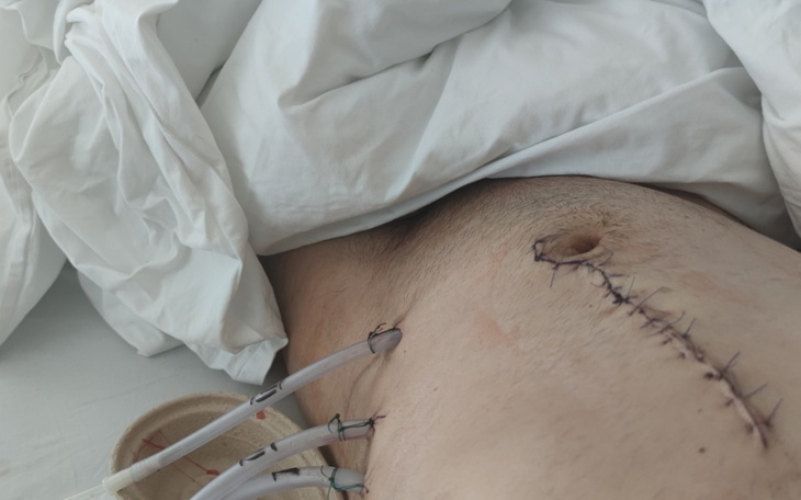 Zbiórka Start z nową śledzioną - zdjęcie główne