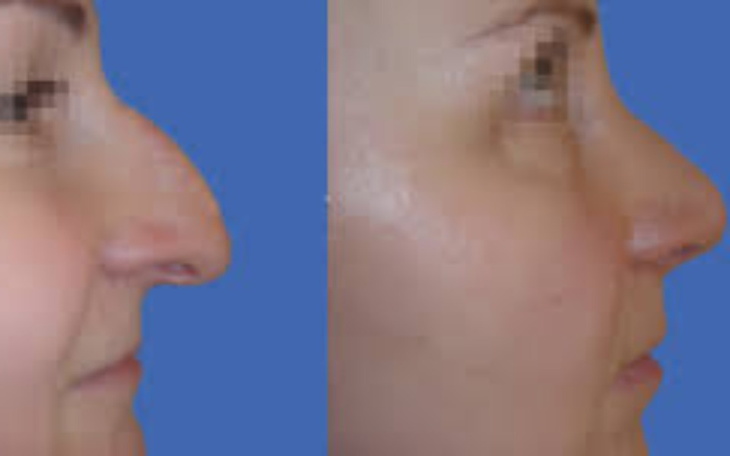 Zbiórka Pomoc w marzeniu o lepszym życiu - zdjęcie główne