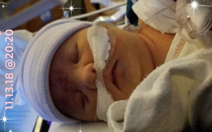 Zbiórka Operacja na OTWARTYM SERCU - zdjęcie główne