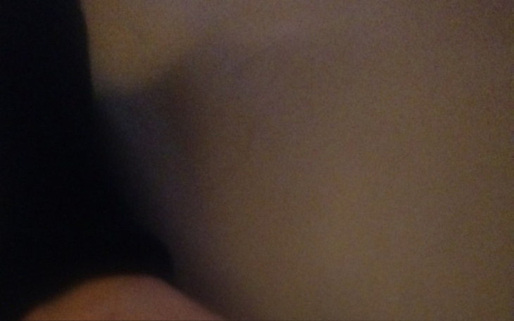 Zbiórka Leczenie nogi - zdjęcie główne