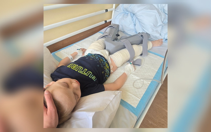 Dziecko leżące w szpitalnym łóżku z opatrunkami.