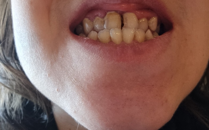 Zbiórka W końcu chce się uśmiechać - zdjęcie główne