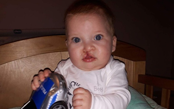 Zbiórka Szymek -  rozszczepowe marzenia - zdjęcie główne