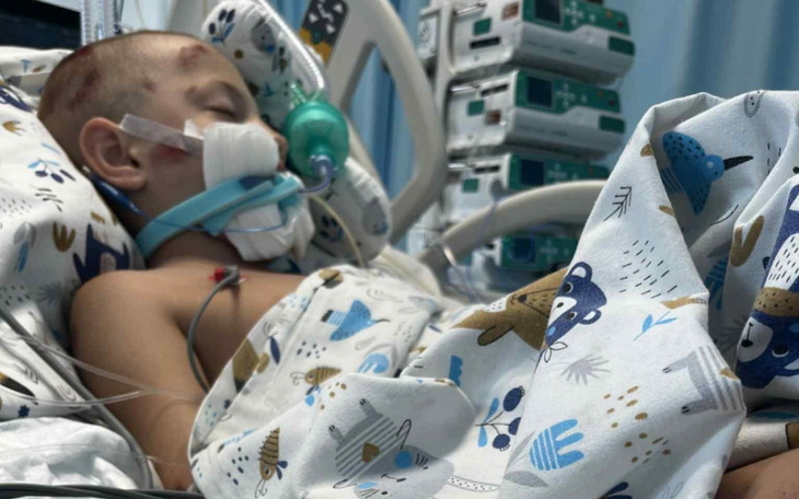 Chłopiec w szpitalu, podłączony do aparatury medycznej.