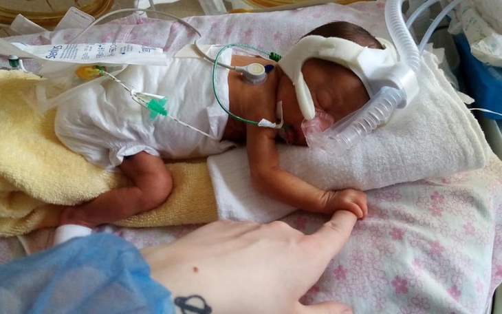 Zbiórka 1205 gramów cudu/WCZEŚNIAK ZUZIA - zdjęcie główne