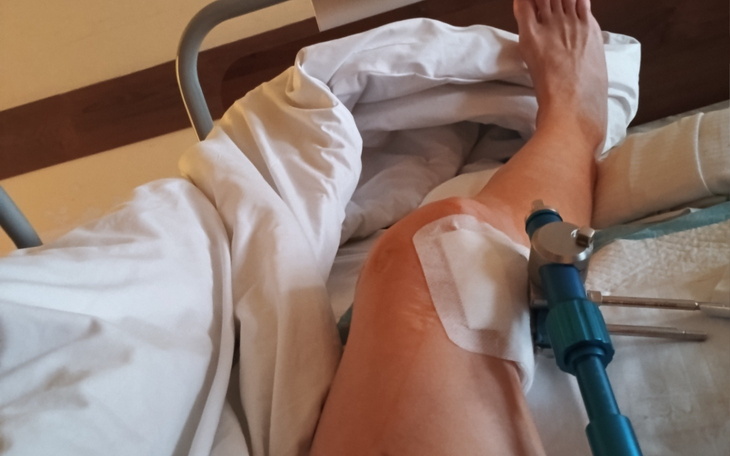Osoba po operacji kolana, leżąca w łóżku szpitalnym.