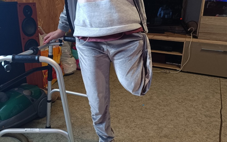 Zbiórka Zbiórka na protezę nogi...... - zdjęcie główne