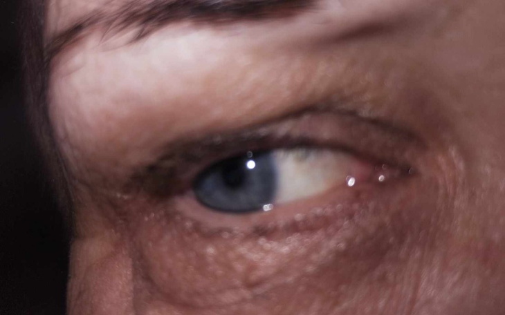 Zbiórka Operacja siatkówki w oczach - zdjęcie główne