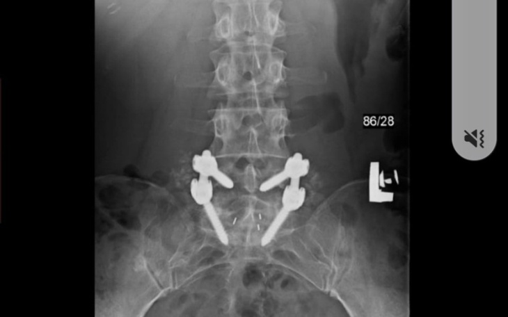 Zbiórka Na leczenie po operacji i chemio - zdjęcie główne