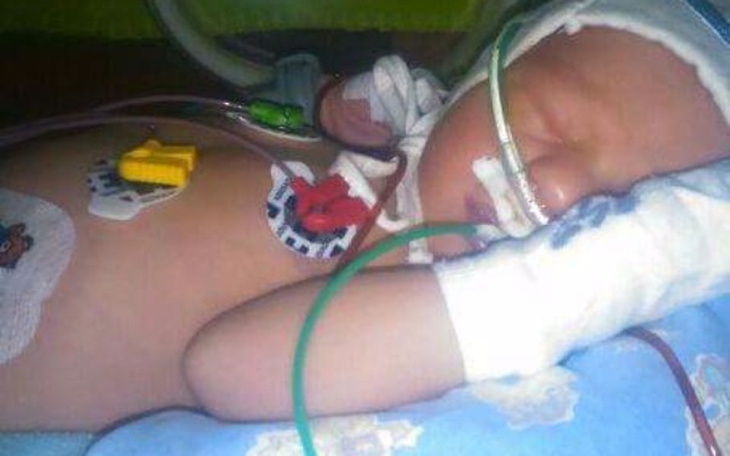 Noworodek w inkubatorze z podłączonymi urządzeniami medycznymi.