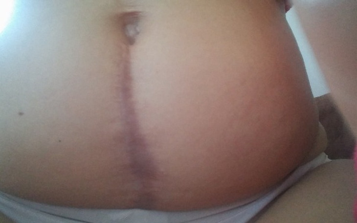 Zbiórka Blizna i garbaty nos - zdjęcie główne