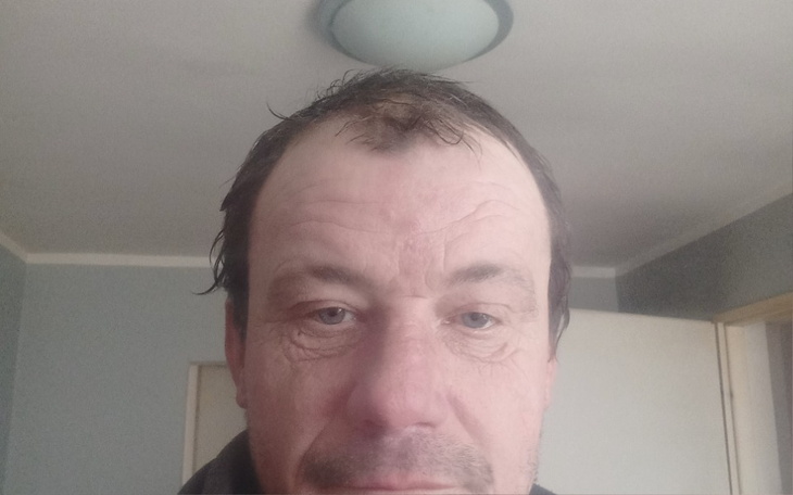 Zbiórka Proteza na lewa noge - zdjęcie główne