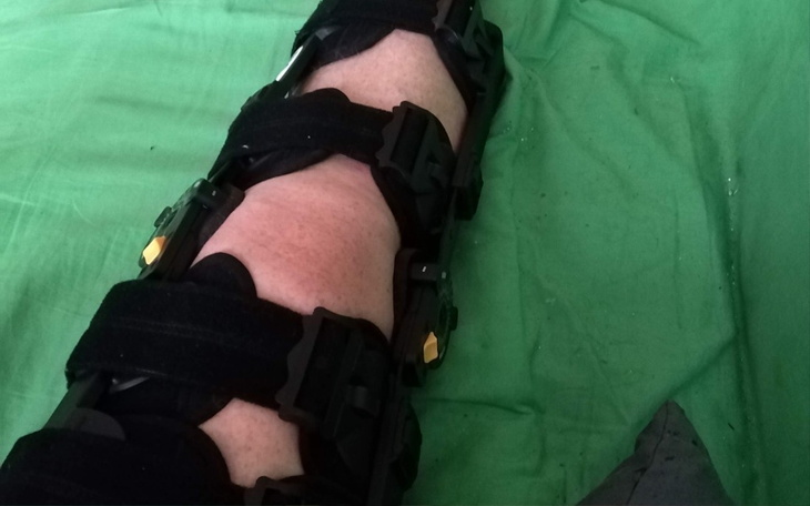 Zbliżenie na nogę w ortezie, leżącą na zielonym tle.