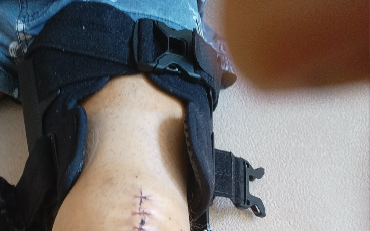 Zbiórka rzepka - zdjęcie główne