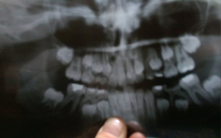 Zbiórka Ładny  uśmiech - zdjęcie główne