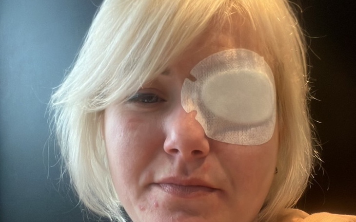 Kobieta z opatrunkiem na oku, wyglądająca na zamyśloną.