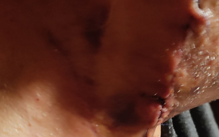 Zbiórka Miażdżyca , samoutrzymanie , opł - zdjęcie główne