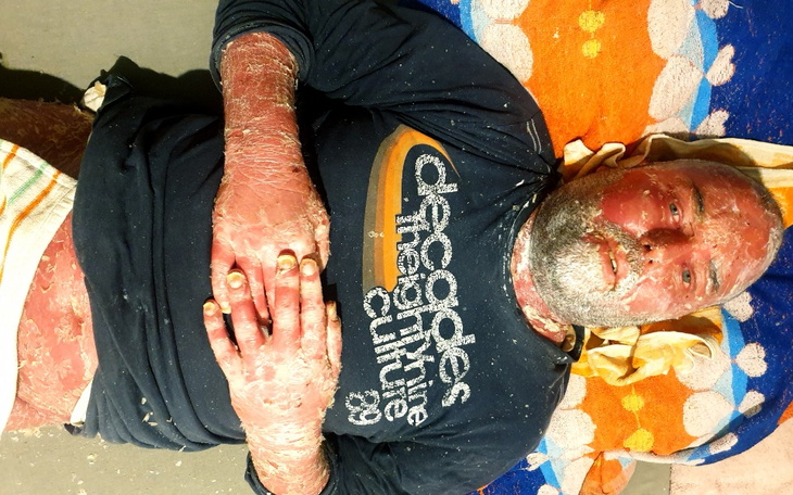 Zbiórka Pomoc dla Artura Powały - zdjęcie główne