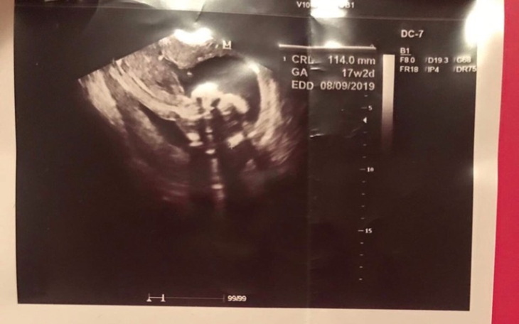 Zbiórka Zbiórka dla małego Michasia - zdjęcie główne