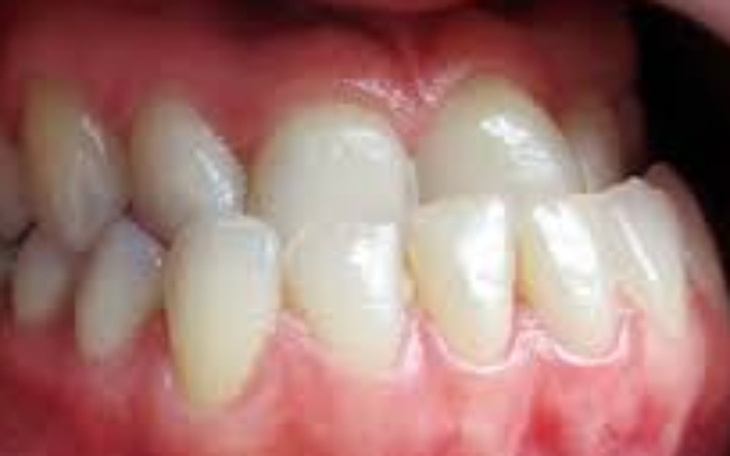 Zbiórka Na szczegółowe badania szczeki - zdjęcie główne