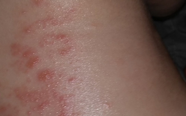 Zbiórka Na leki dla syna na AZS - zdjęcie główne