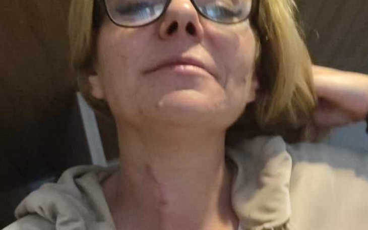 Zbiórka Leczenie operacja kregoslupa - zdjęcie główne