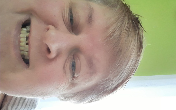 Zbiórka Leczenie jamy ustnej - zdjęcie główne