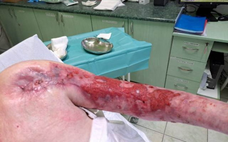 Zbiórka Opatrunki dla Roberta - zdjęcie główne