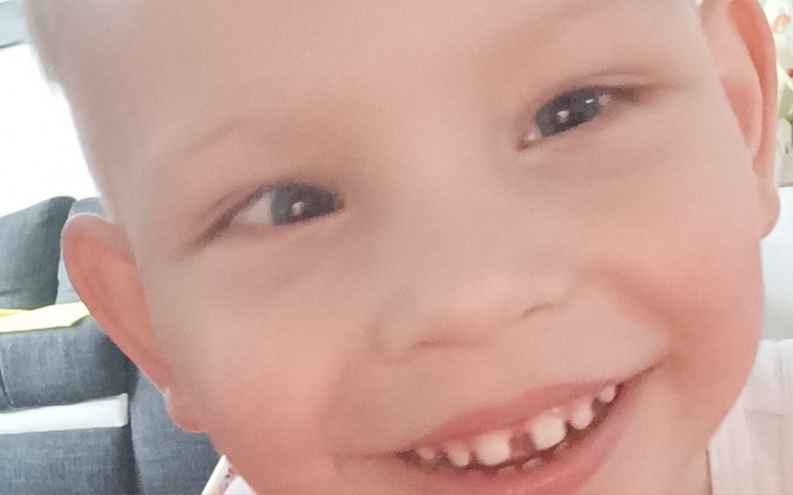 Zbiórka Turnus z mikropolaryzacja mózgu - zdjęcie główne