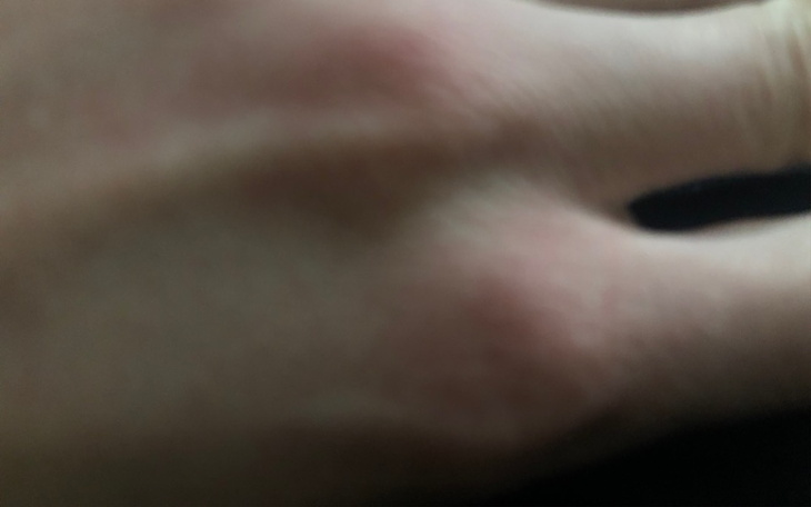 Zbiórka Na rzeczy do higieny - zdjęcie główne