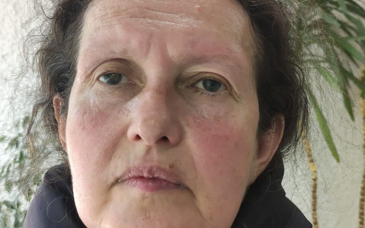 Zbiórka Nadzieja na lepsze widzenie - zdjęcie główne