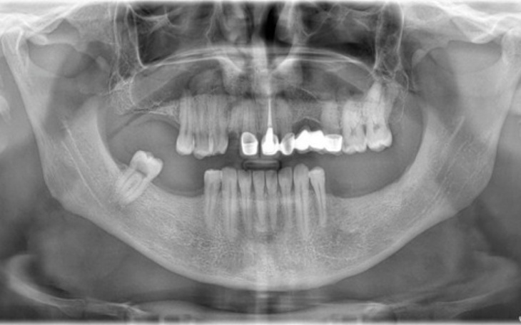 Zbiórka niezbędna Naprawa uzębienia - zdjęcie główne