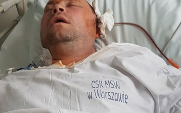 Zbiórka Pomoc dla Piotra po tętniaku - zdjęcie główne