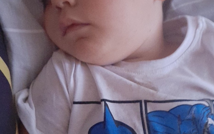 Zbiórka Na operacje uszu synka - zdjęcie główne