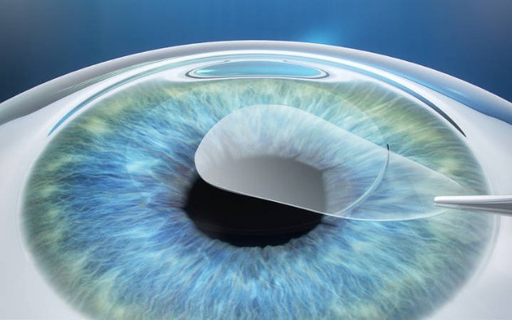 Zbiórka korekcjaa - zdjęcie główne