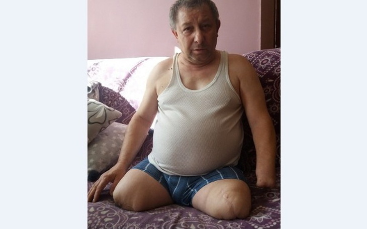 Zbiórka Na protezy nóg i lewej dłoni - zdjęcie główne